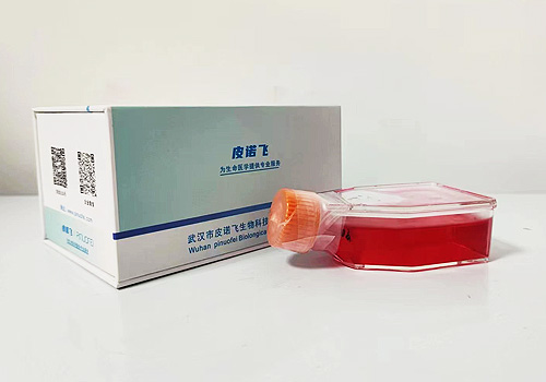 Jurkat Clone E6-1人T淋巴細(xì)胞白血病細(xì)胞（STR鑒定正確）