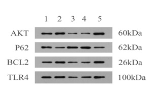Western Blot：探索蛋白質(zhì)表達(dá)與相互作用的有力工具