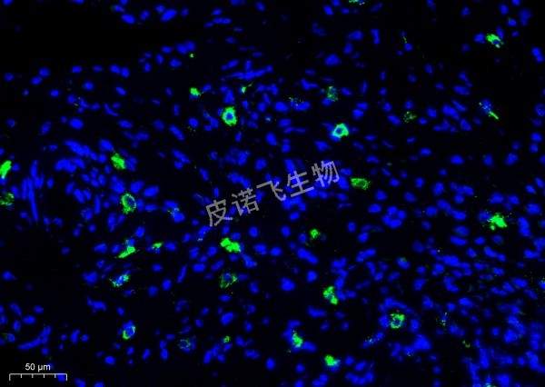 CD47綠_腫瘤