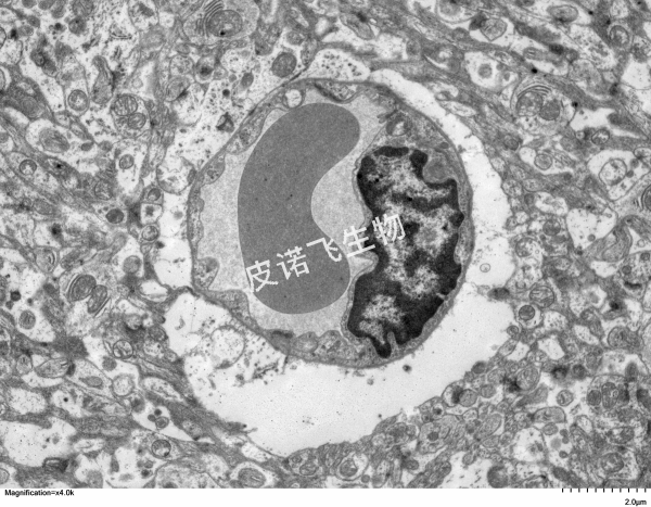 血腦屏障