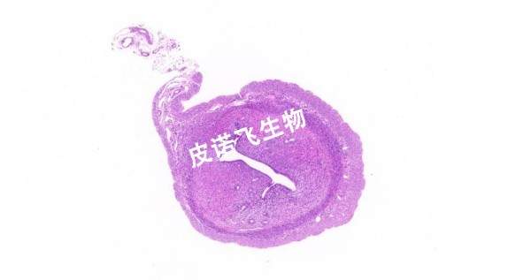 子宮_HE