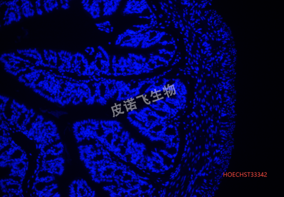 Hoechst染色