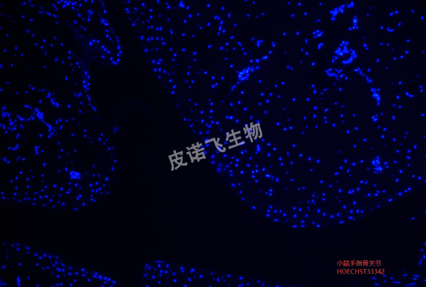 小鼠手指骨關(guān)節(jié)HOECHST33342.png
