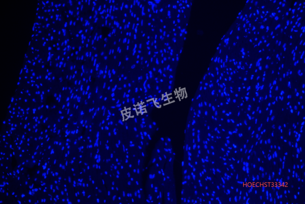心臟HOECHST33342.png