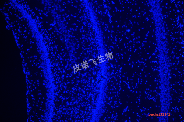 腦hoechst33342.png