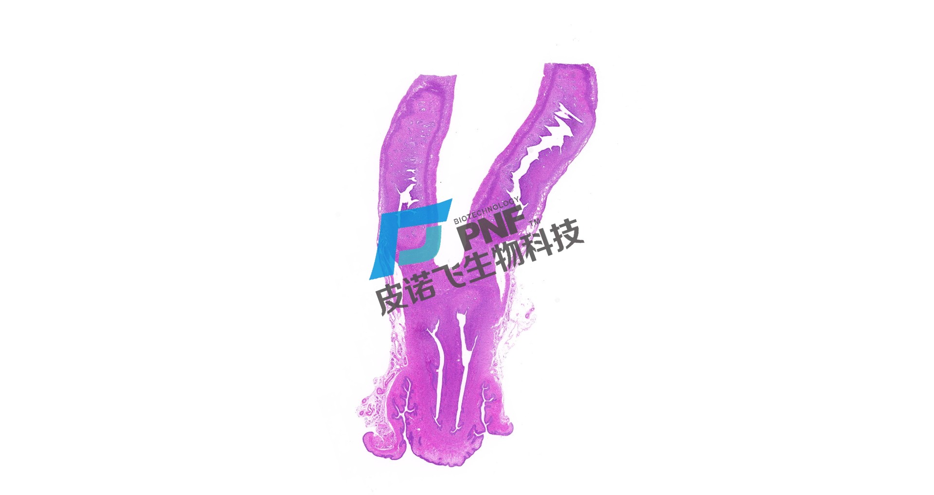 HE染色